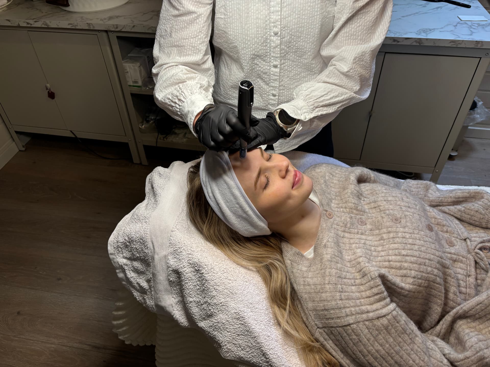 Microneedlingbehandling utført hos L Estetisk Klinikk